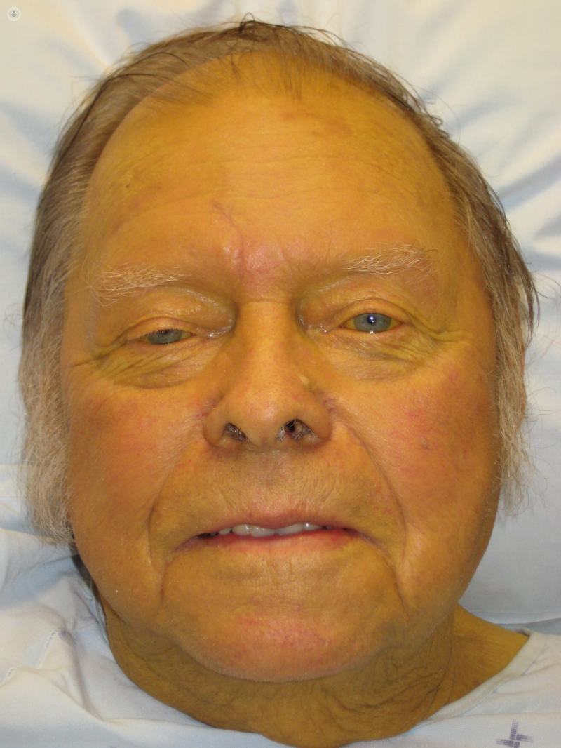 <p>Pathological discoloration</p>