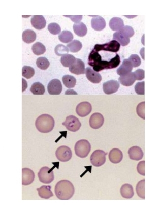 <p>appears as safety pin and maltese cross in erythrocytes </p><p>what is the disease? </p><p>a fatal tick transmitted - what r the ticks involved?</p>