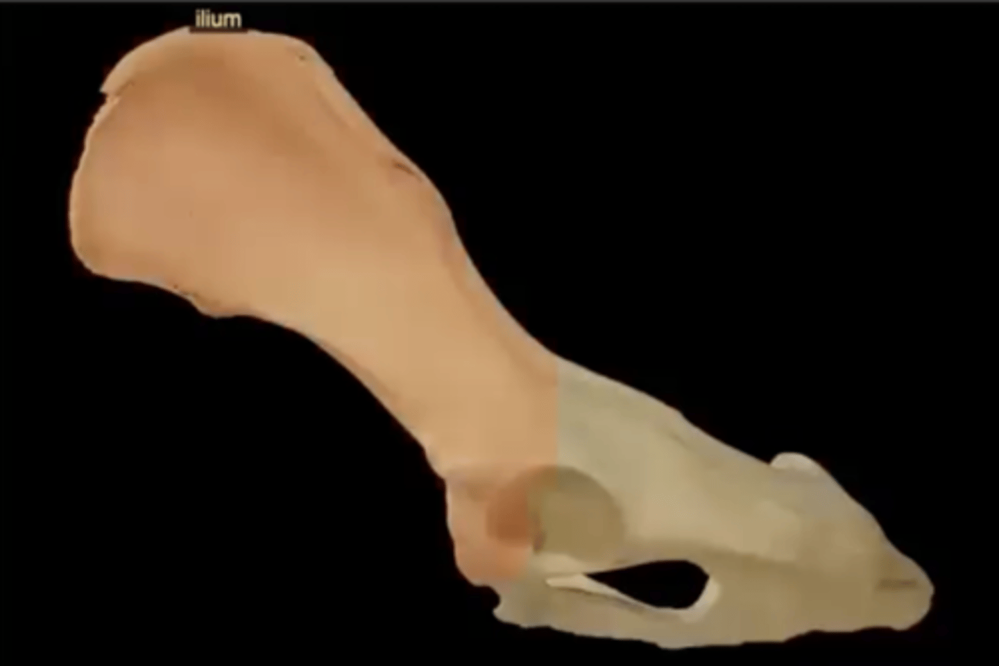 <p>largest and most superior past of the os coxae</p>