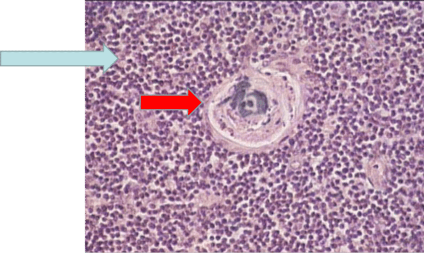 <p>Where is this tissue located? thymus</p>