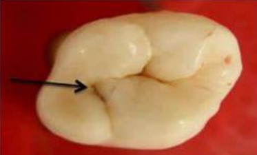 <p>Occlusal View</p>