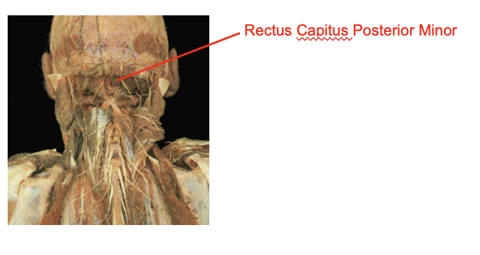 <ul><li><p>rectus capulus posterior minor</p></li></ul><p>Origin</p><ul><li><p>posterior tubercel of the atlas</p></li></ul><p>Insertion</p><ul><li><p>occipital bone</p></li></ul><img src="https://knowt-user-attachments.s3.amazonaws.com/57e2bb19-89ac-40bb-9990-7e4900a238b0.png" data-width="100%" data-align="center"><p></p>