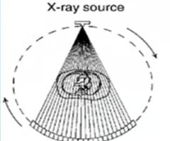 <p>3rd generation (fan beam rotate only)</p>