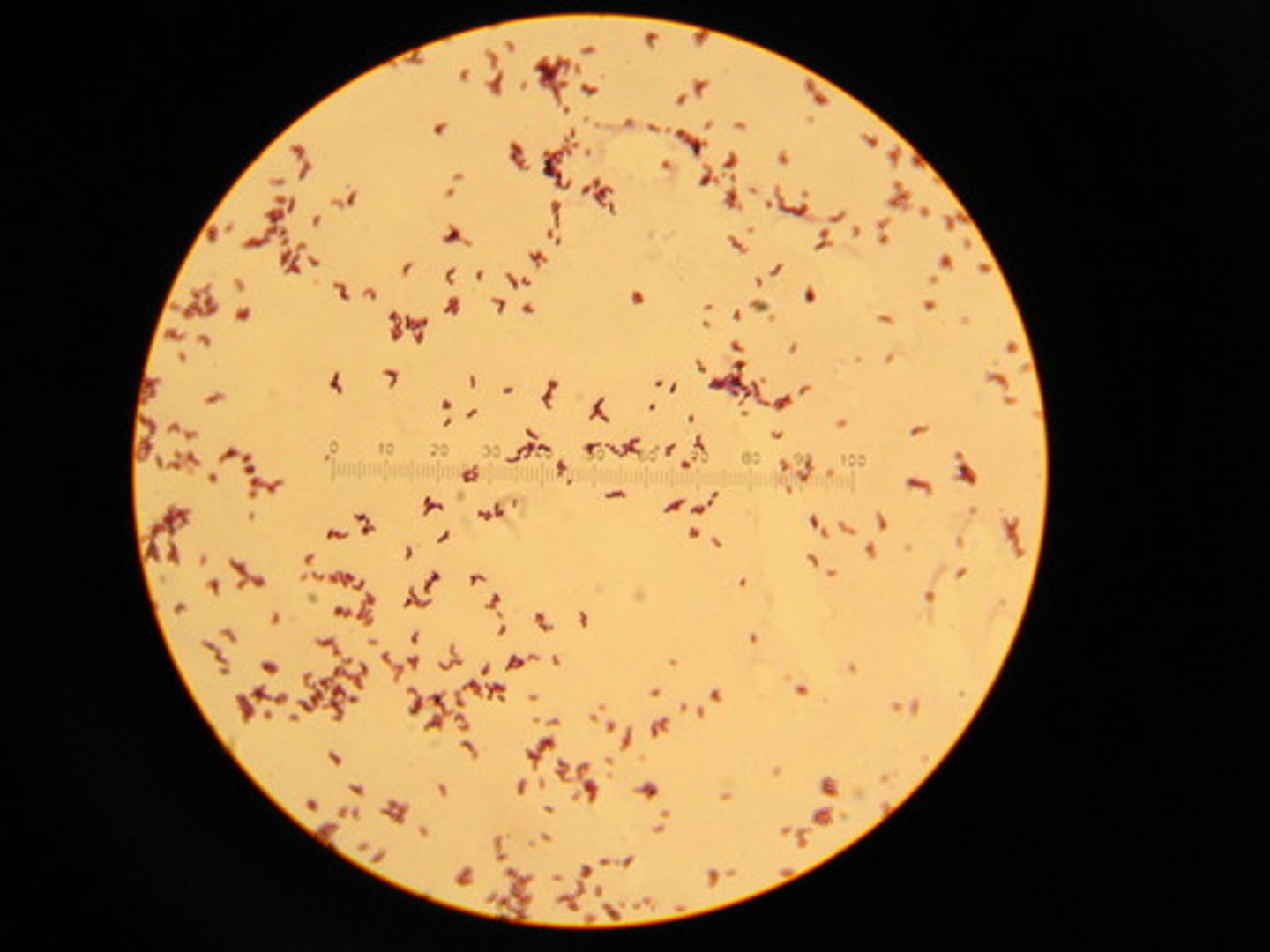 <p>A stain used to dye unstained cells a contrasting color in a differential stain<br>Safranin, Safranin, Methylene blue</p>