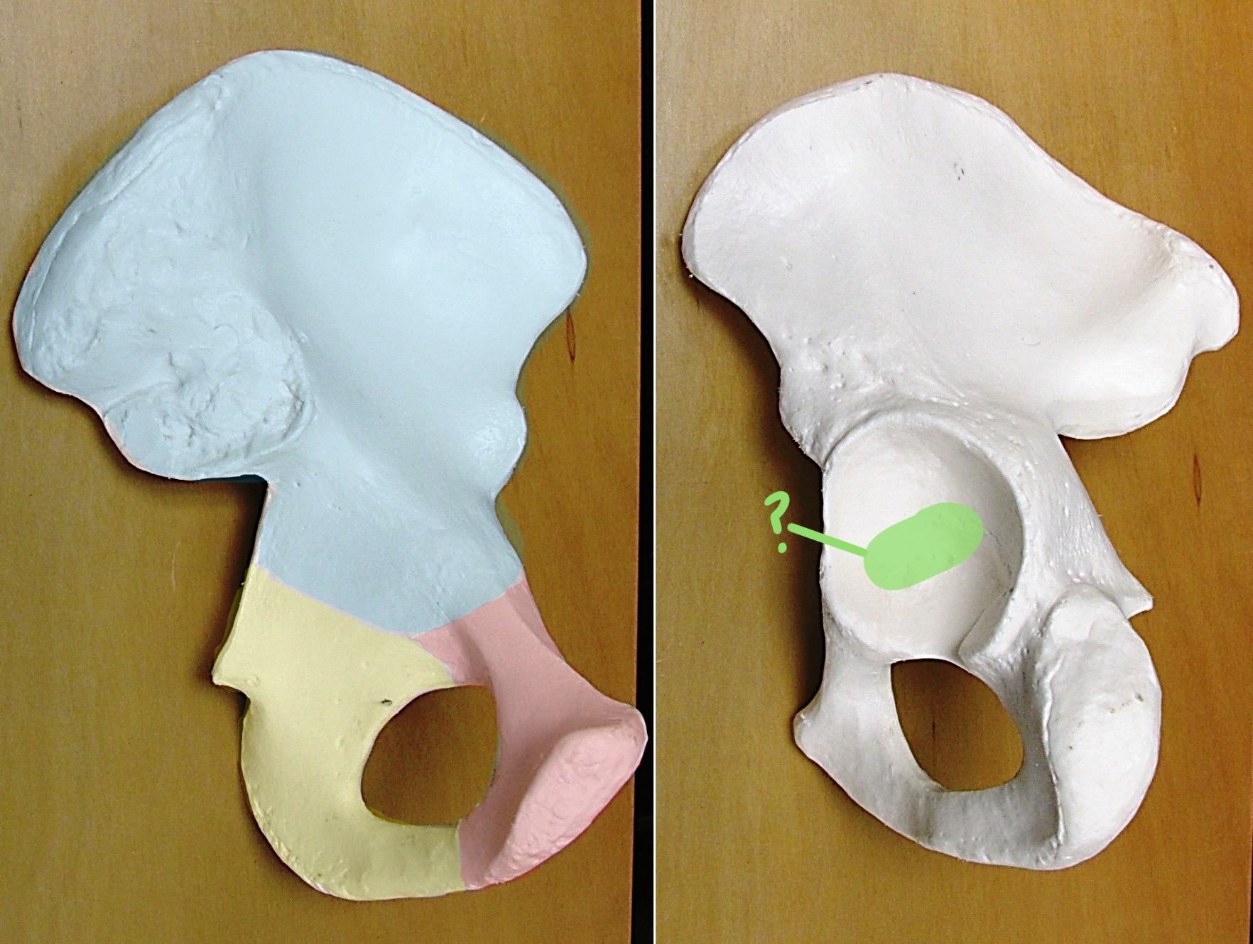 <p>Determine the part of the Coxa highlighted</p>
