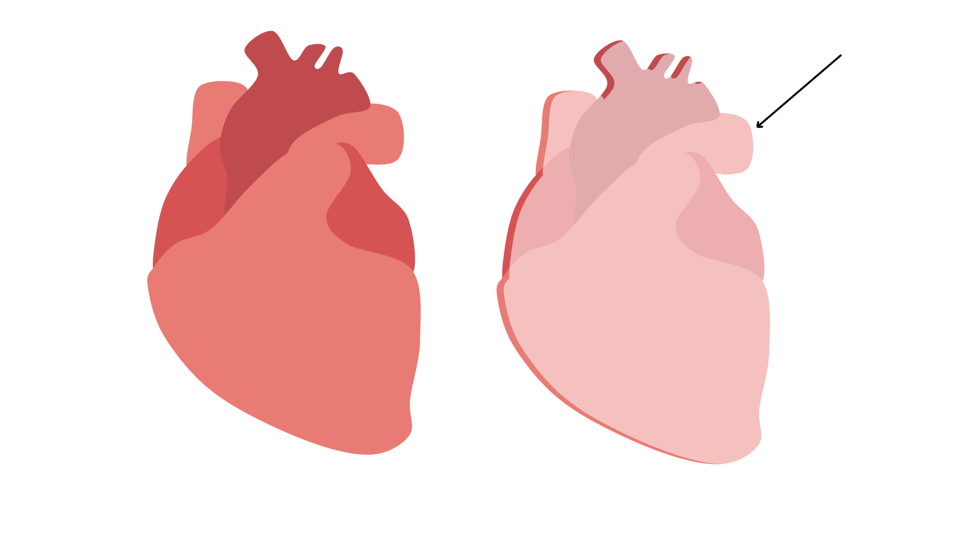 <p>Visceral pericardium</p>