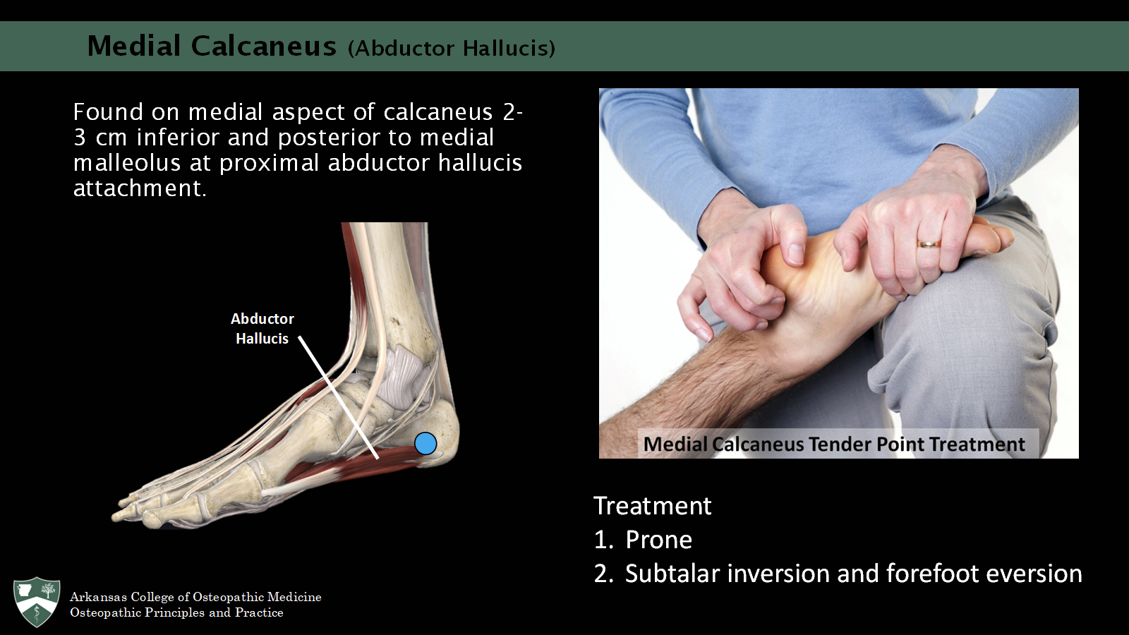 <p>Found on medial aspect of calcaneus 2-3 cm inferior and posterior to medial malleolus at proximal abductor hallucis attachment.</p><p>tx: prone, subtalar inversion and forefoot eversion </p>