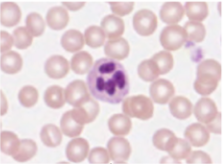 <p>identify the leukocyte</p>