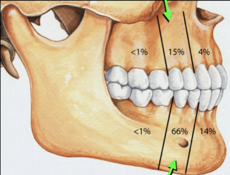 <ul><li><p><strong>Side of root, not apical</strong></p></li><li><p><strong>2nd premolar to lateral incisor</strong></p></li></ul><p></p>