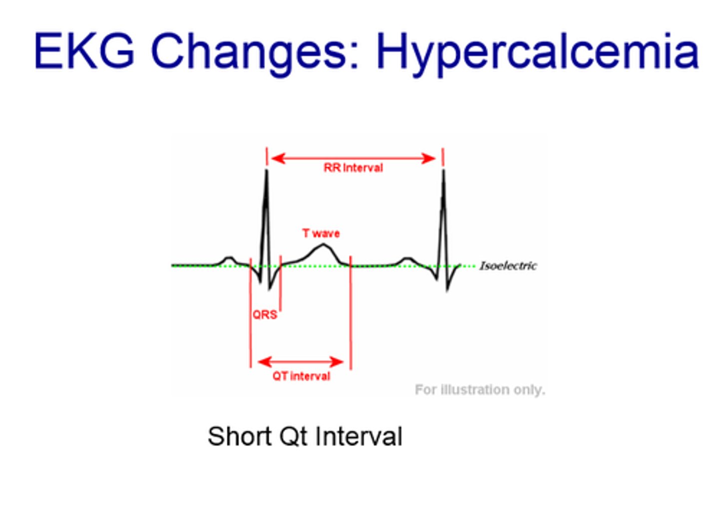 <p>ECG Changes</p><p>-wide QRS and short QT</p><p>-increased heart actions</p>