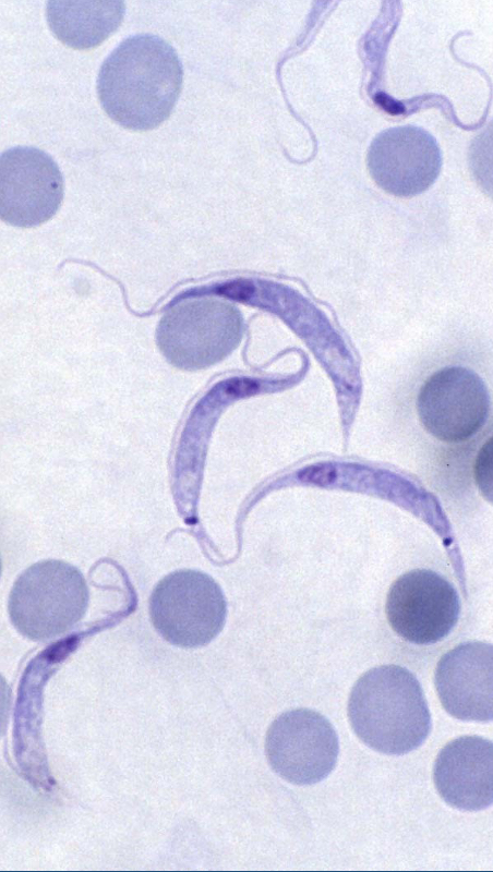 <p>What parasite is this?</p>