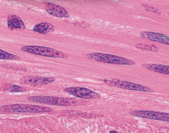 <p>What Muscle Tissue is this?</p>