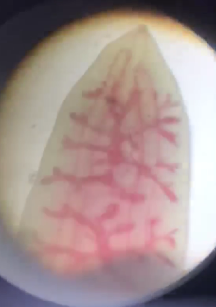 <p>Trematoda; human liver fluke</p>