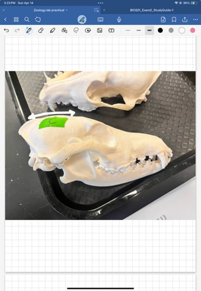 <p>a ridge along the top of the skull where the parietal bones meet in the middle. forms point for temporalis muscle</p>