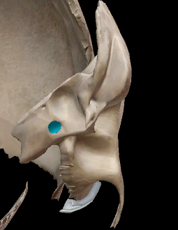 term image