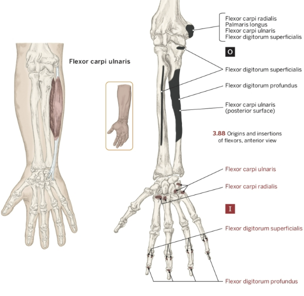 <p>Insertion of Flexor Carpi Ulnaris</p>
