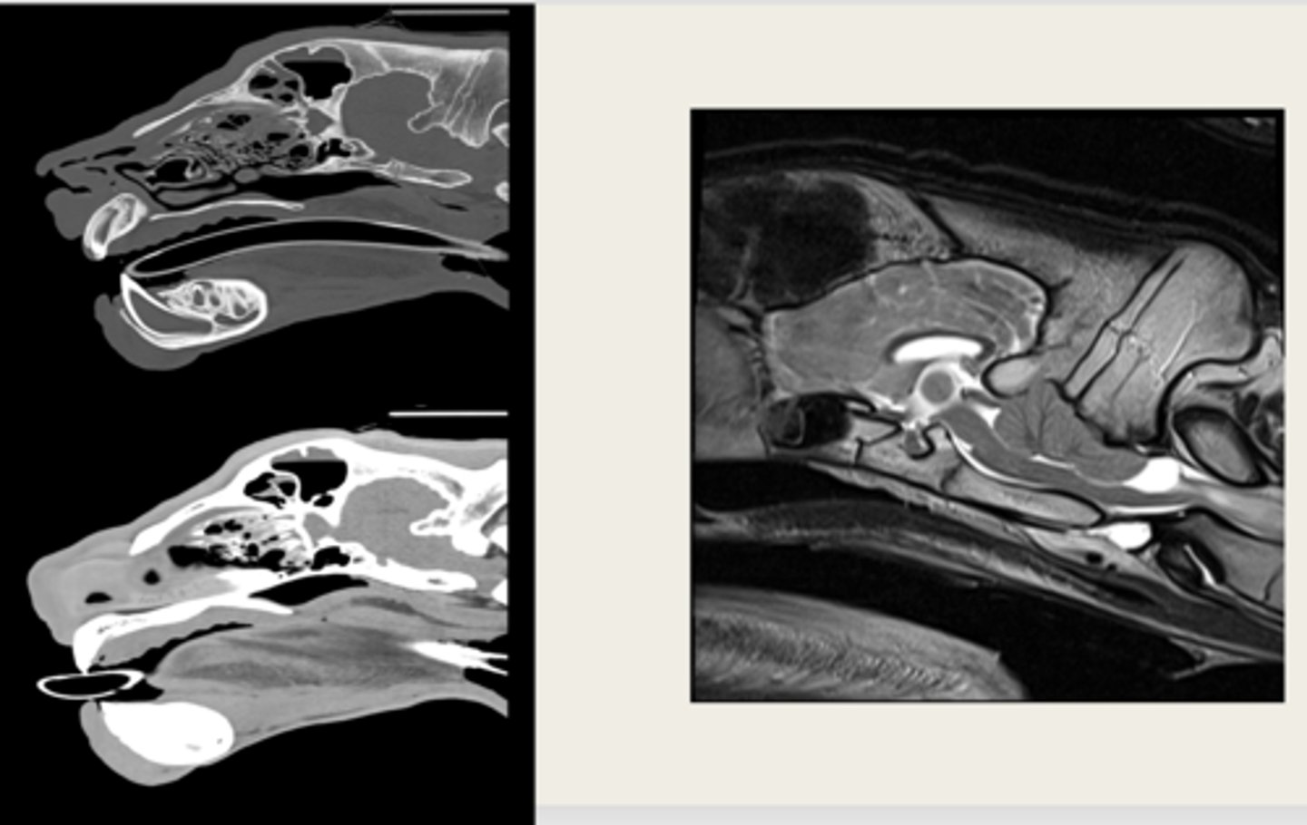 <p>which images are CT and which are MRI?</p>