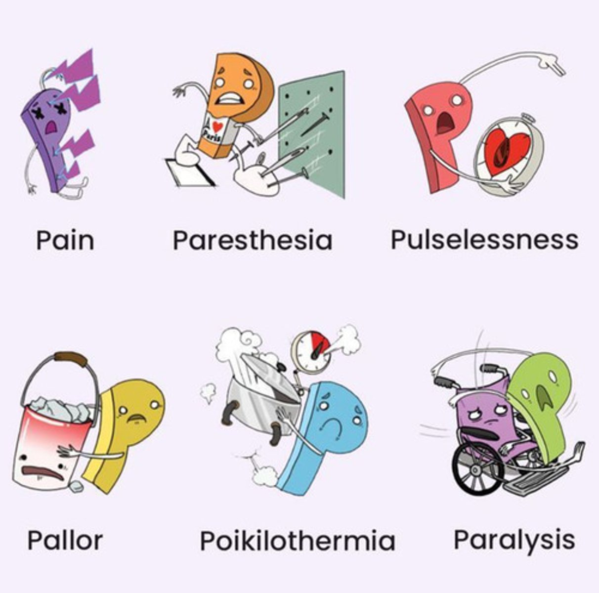 <p>The "6 P's"</p><p>- worsening pain (sudden)</p><p>- pallor</p><p>- paresthesia (pins &amp; needles, nerve supply is impacted)</p><p>- puffy (edema)</p><p>- paralysis (of distal segments)</p><p>- pulses are usually normal!!!</p>