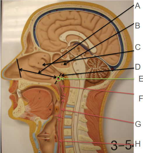 <p>C</p>