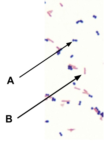 <p>ID the gram + Enterococcus</p>