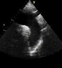 <p>Identify this image. </p>