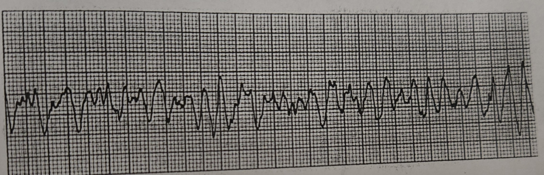 <p>What Rhythm is this?</p>