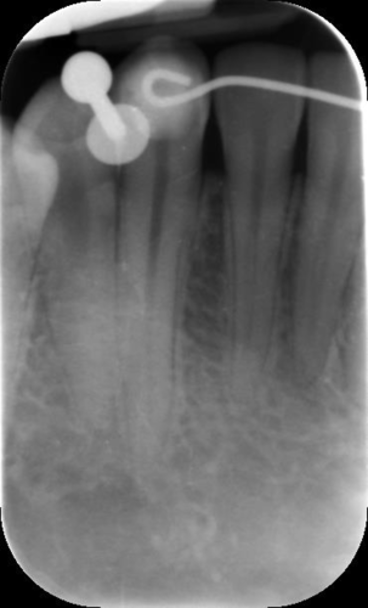 <p>What is this error?</p>