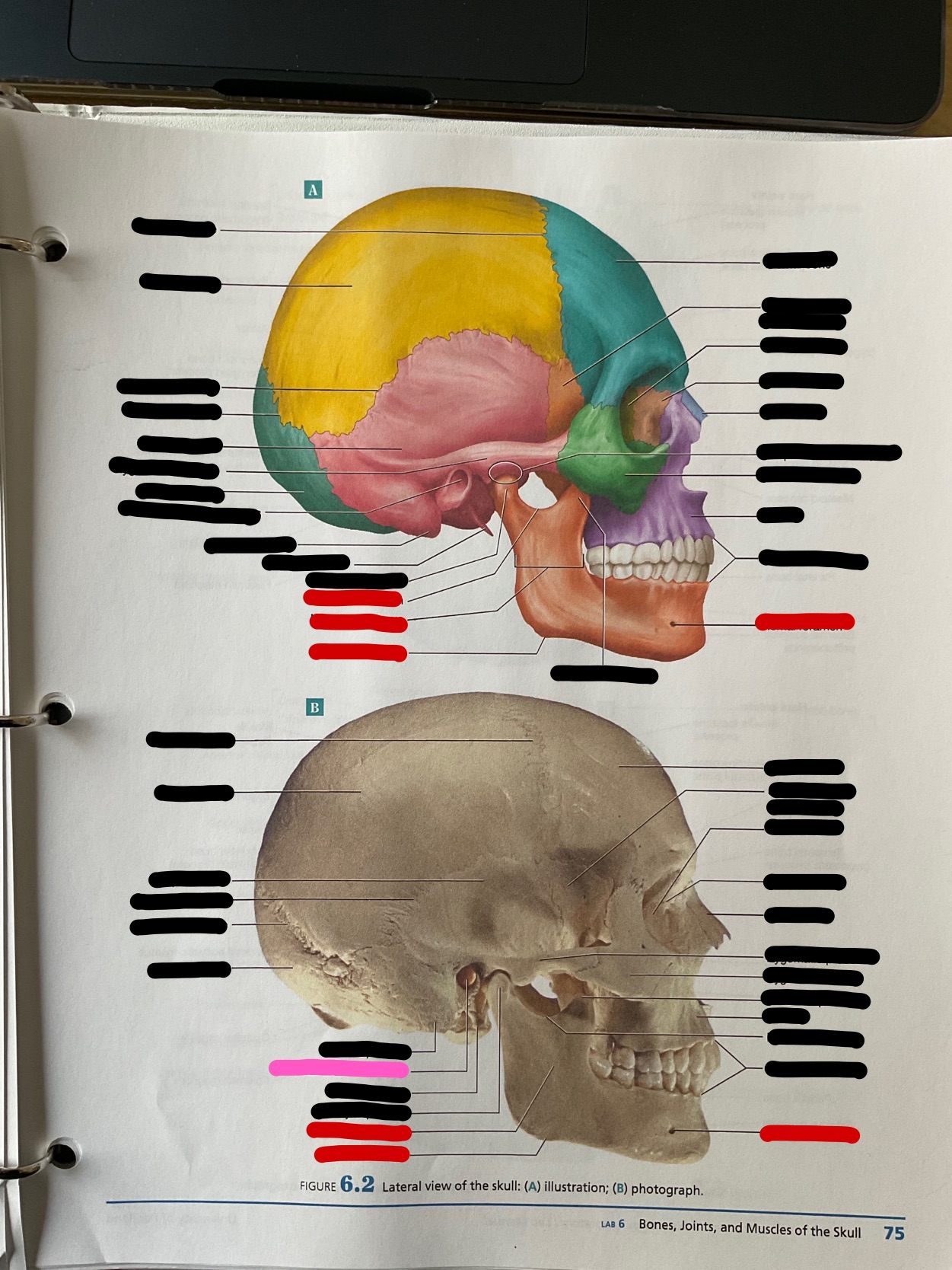 What bone is this?