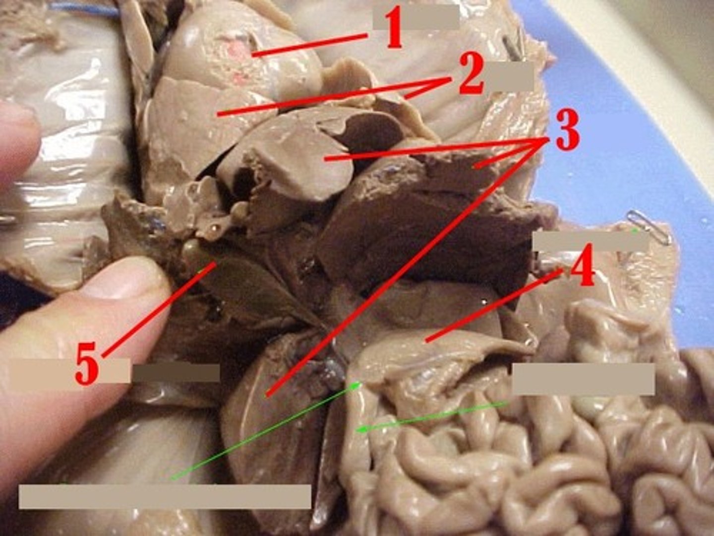 <p>#5</p>