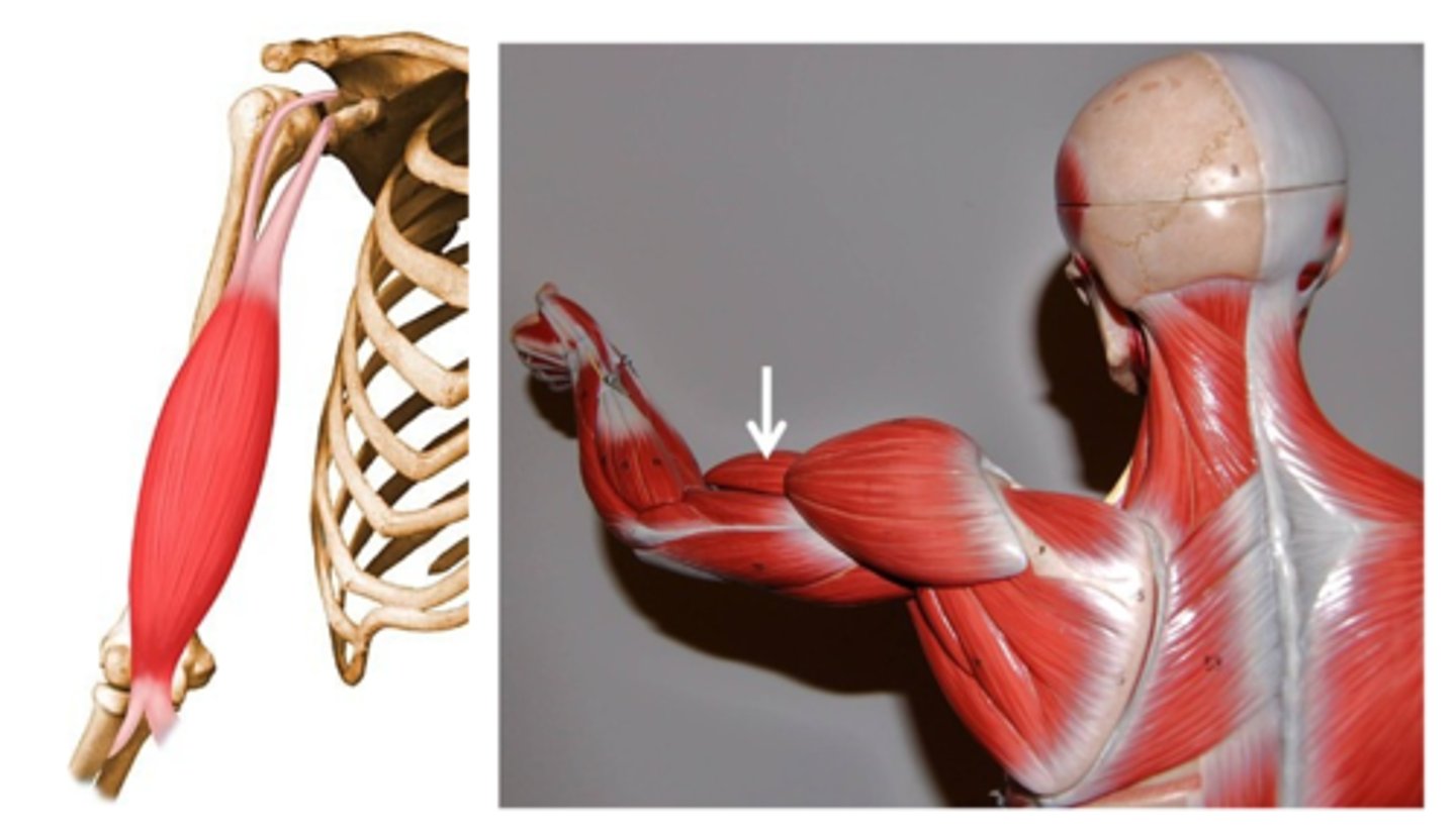 <p>Biceps brachii, short head:</p><p>Origin: Coracoid Process</p><p>Insertion: Radial Tuberosity</p><p>Biceps brachii, long head:</p><p>Origin: Glenoid Cavity</p><p>Insertion: Radial Tuberosity</p>