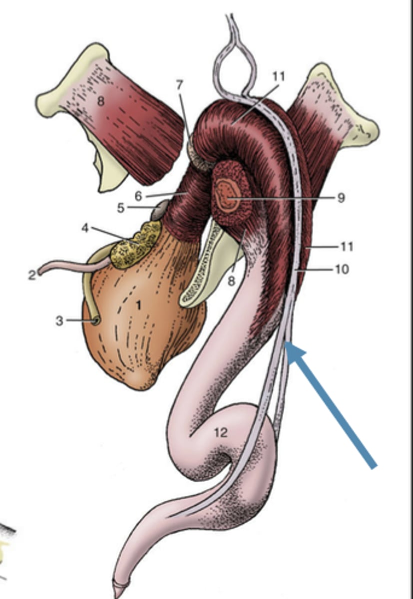 <p>-Muscle responsible for retracting the penis back into the abdomen and prepuce</p>