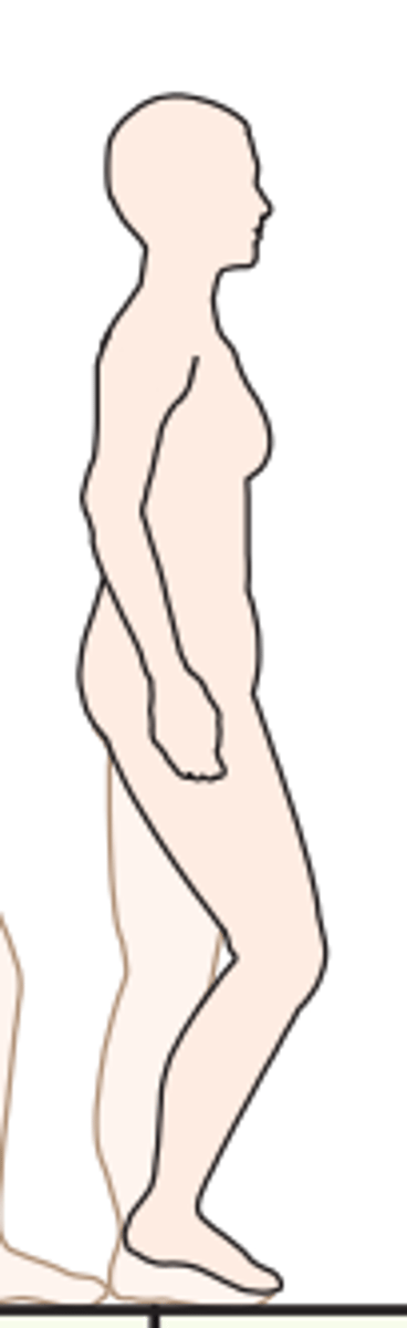<p>What stance is this according to Ranchos Los Amigos?</p>