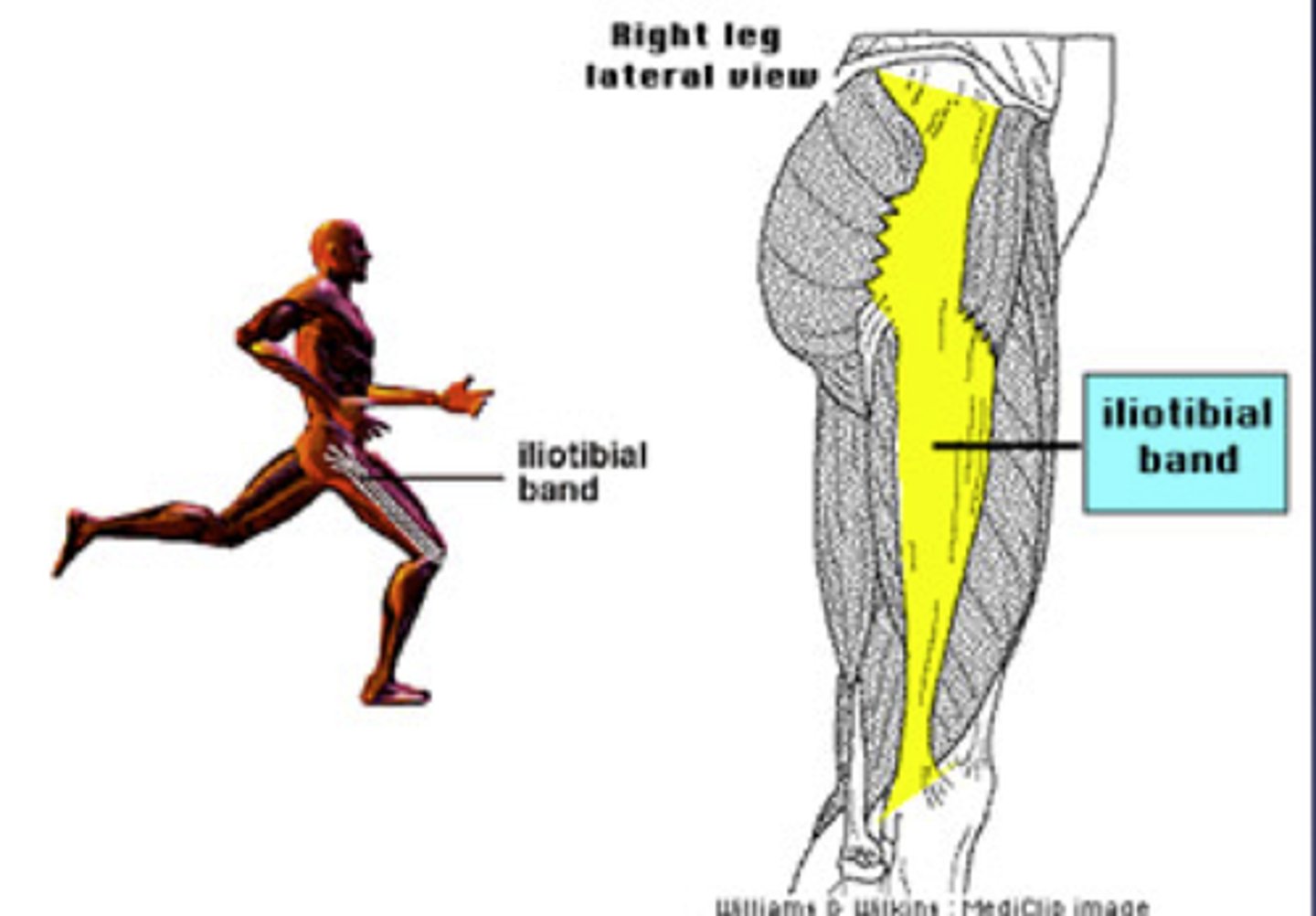 <p>- tendinitis</p><p>- frequently seen in downhill runners</p><p>- associated with patellofemoral pain</p><p>- ITB tightness may be a factor</p><p>- quads and hamstrings also have attachment to lateral intermuscular septum/continuous with ITB</p><p>HINT: glut max and tendinitis insert here</p>