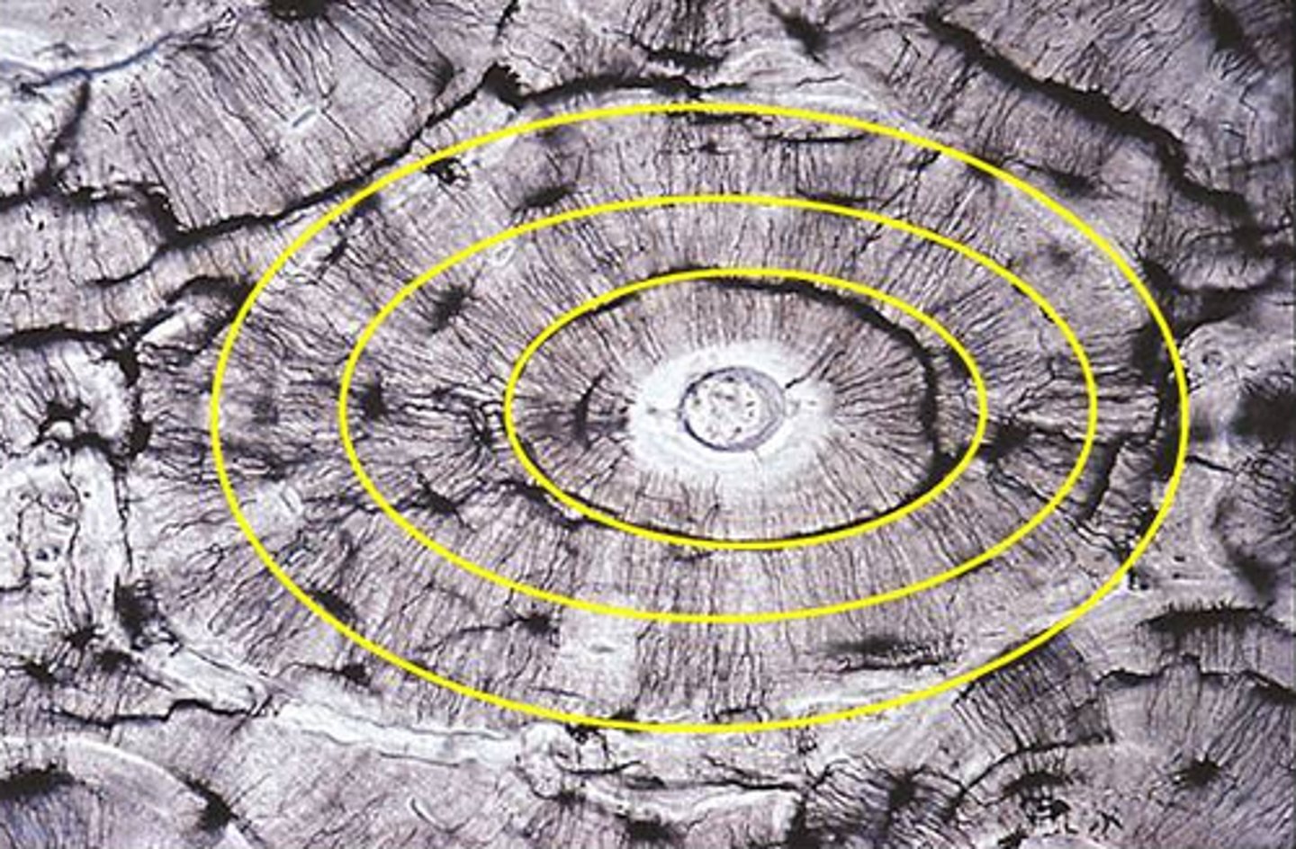 <p>calcified concentric rings made up of groups of hollow tubes of bone matrix; surround haversian canals</p>