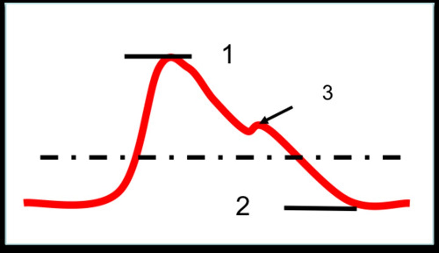 <p>ventricle contraction (1)</p>