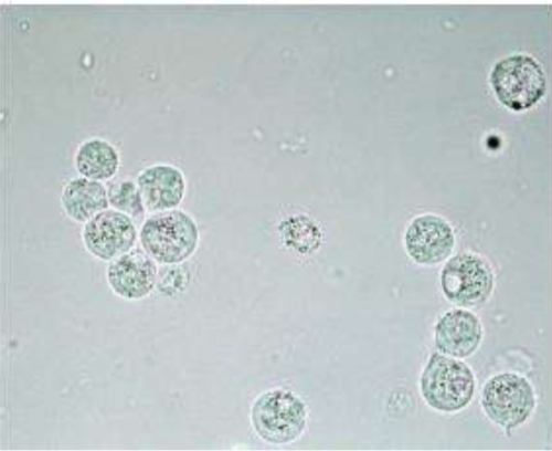 <p>These cells are present on sediment evaluation. What are they?</p>