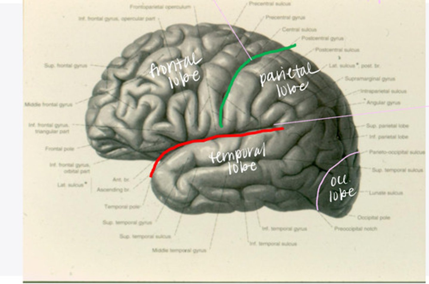 <p>What sulcus differentiates the frontal from the parietal lobe?</p>