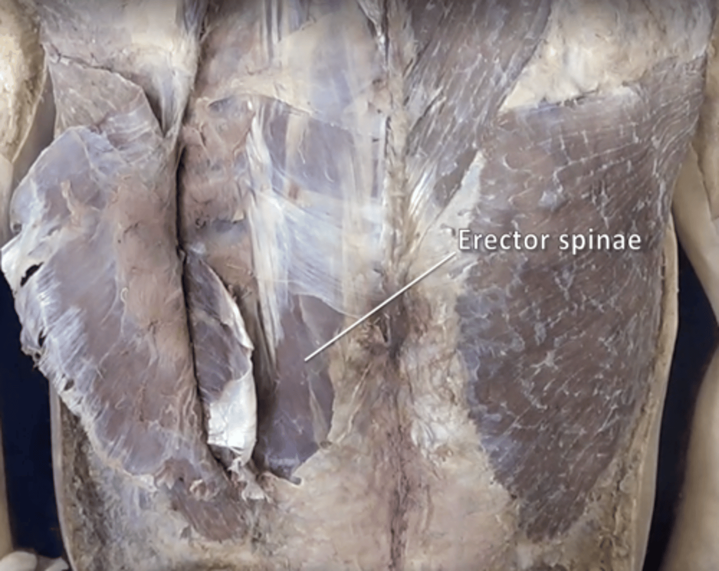 <p>contains iliocostalis, longissimus, and spinalis muscle</p>