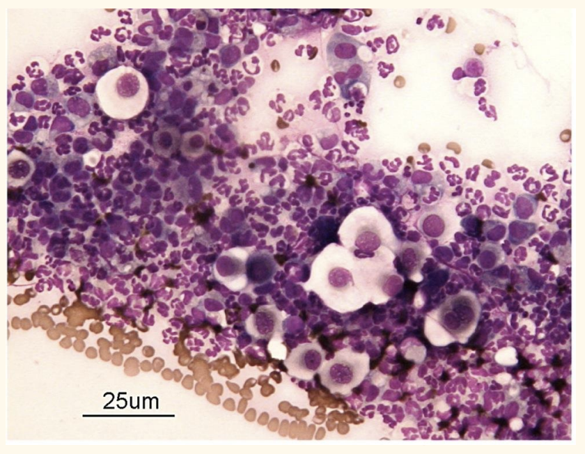 <p>Identify the cells on this impression from a crust</p>