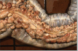 <p>Describe this pathology in a foal and state the aetiological agent</p>