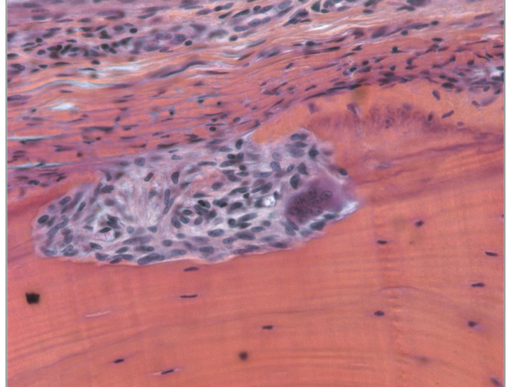 <p>what does this histological image show</p>