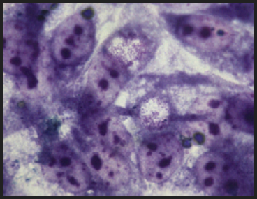 <p>What parasite is this?</p>