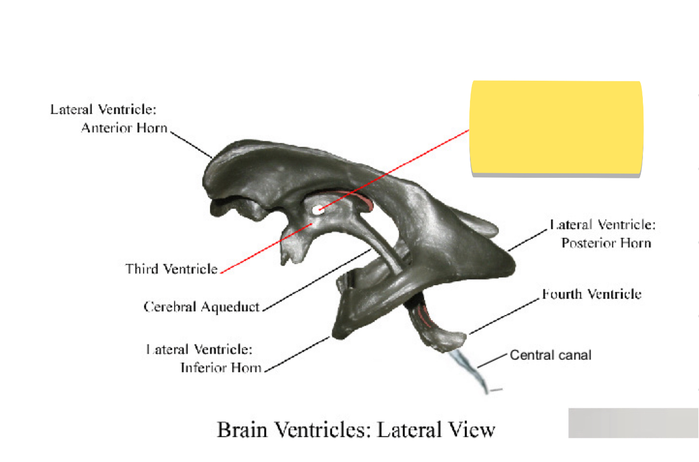 <p>Name this brain ventricle </p>