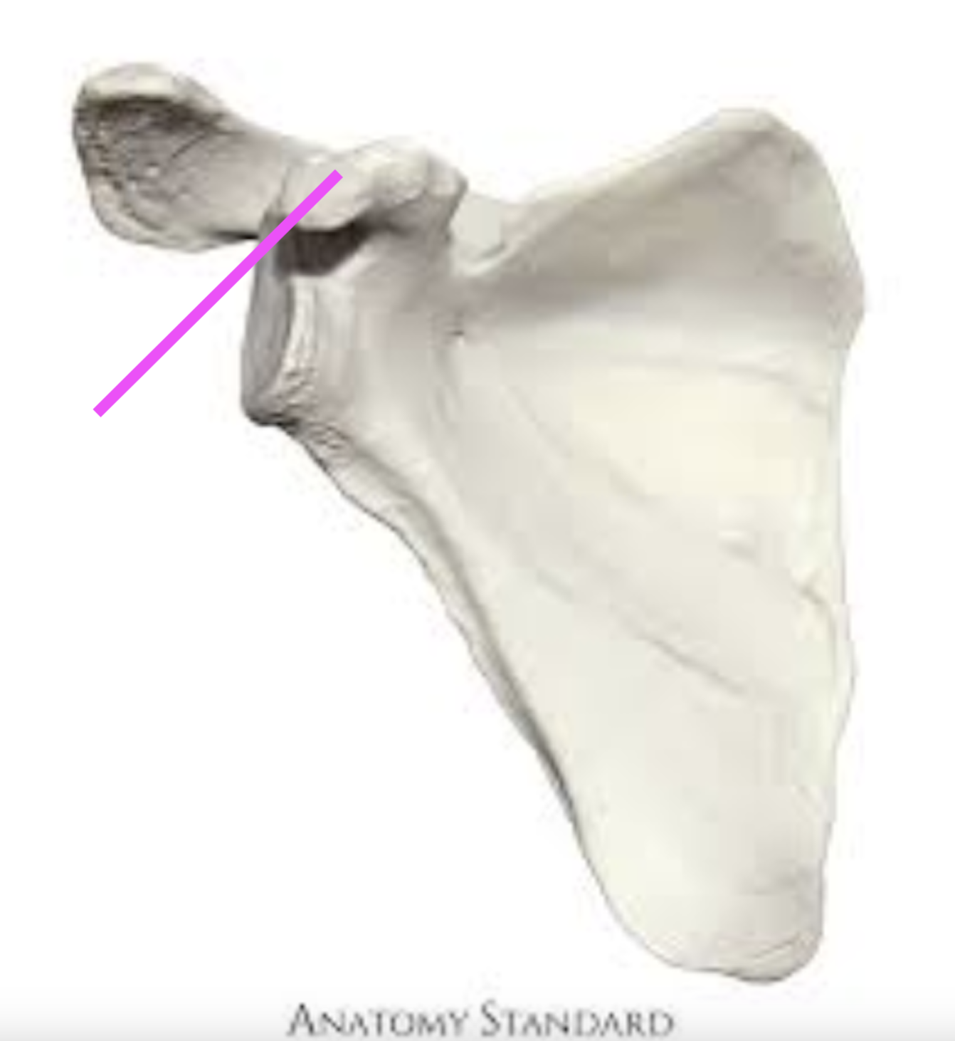 <p>what part of the scapula is this?</p>