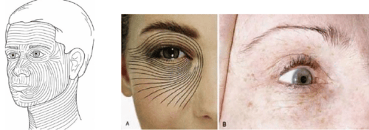 <p>incisions parallel to natural tension (Langer) lines to prevent tension and blend with natural creases</p><p>sharply defined, well aligned edges</p><p>infection management through asepsis</p><p>wound closure with sutures</p><p>sun protection</p><p>silicone gel sheeting/ointments to hydrate straum corneum</p><p>steroid injection for keloids</p>