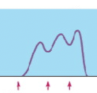 <p>Several stimuli and series so quickly that twitches overlap and cause tension</p>