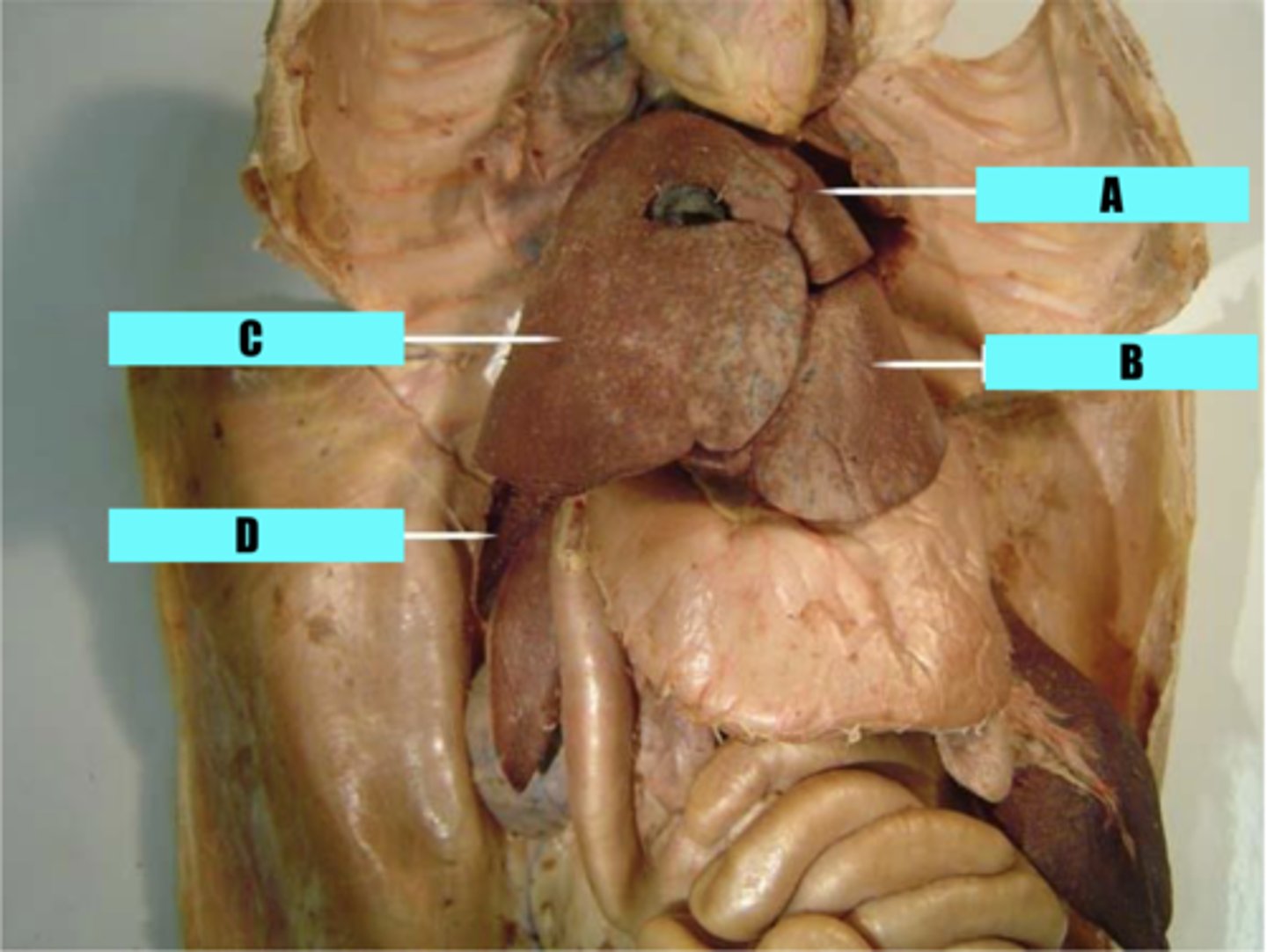 <p>B?</p>