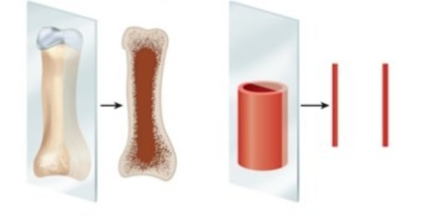 <p>longitudinal section</p>
