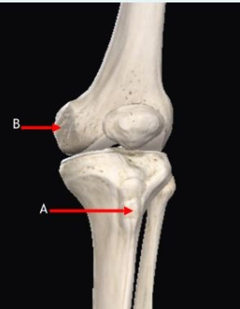 <p>In the image below...</p><p>1) The site labelled A is a palpable landmark called ___</p><p>2) The ligament that attaches to site marked B is called ___</p>