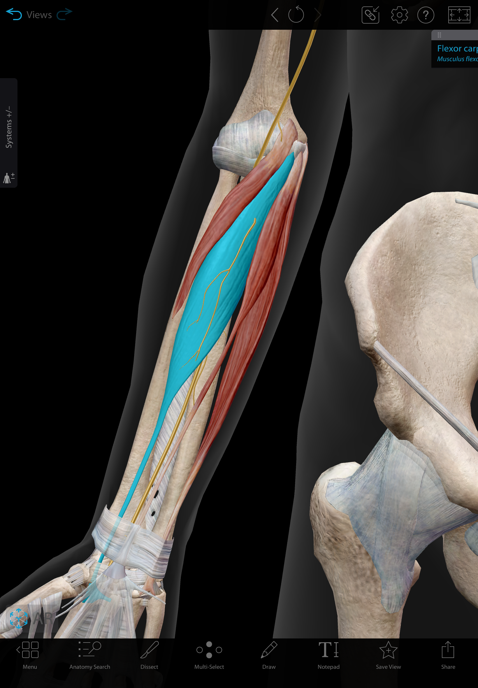 <p>Flexor carpi radialis</p><p>O: Medial epicondyle of the humerus (common flexor origin)</p><p>I: Bases of the second and third metacarpals (on the palmar aspect)</p><p>A: Flexion and radial deviation (Abduction) of the hand at the wrist joint</p><p>IN: Median nerve (C5-C8, T1)</p>
